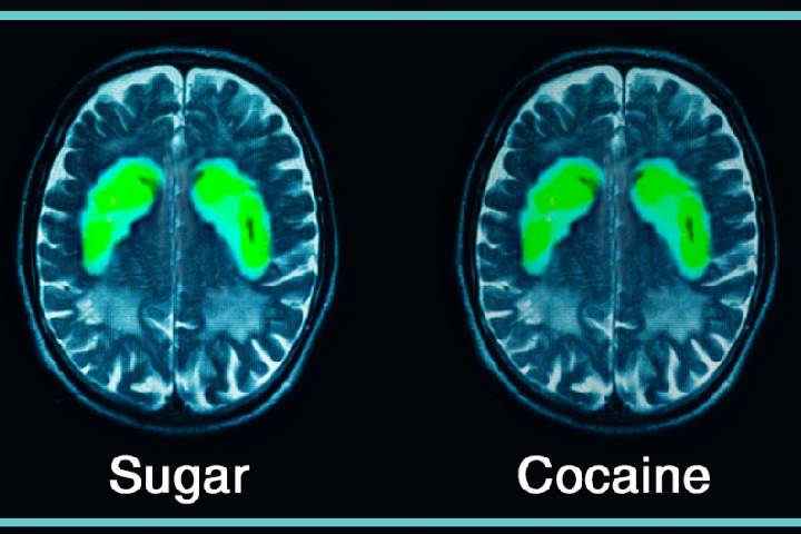ارتباط دوپامین و شکر