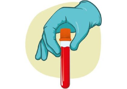 آزمایش خون برای تشخیص سرطان
